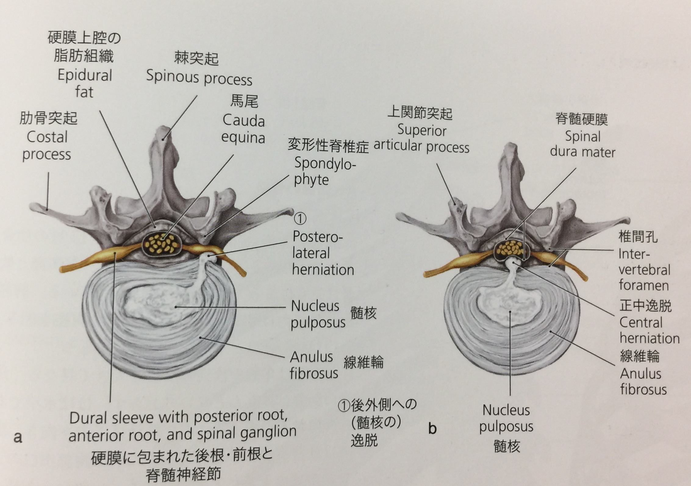解剖学 腰椎、椎間板ヘルニア