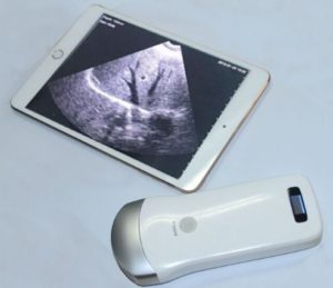 タブレット超音波検査(ultrasound-diagnosis)