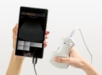 日本シグマックス社のタブレット型超音波画像診断装置「ポケットエコー miruco（ミルコ）」2